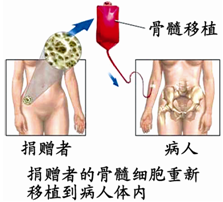 白血病